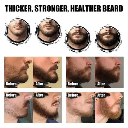 Essence&Form 5-in-1 Beard Growth Kit — Fuller, Healthier Beard Made Simple